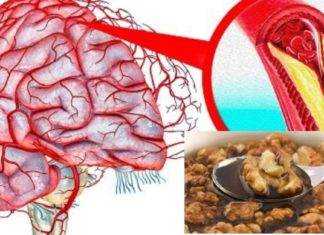 თავის ტკივილი გაქრება და გუნება-განწყობა გაუმჯობესდება – ჩვენ მოვამზადეთ 5 ეფექტური რეცეპტი თავის ტვინის სისხლძარღვების გასუფთავებისთვის