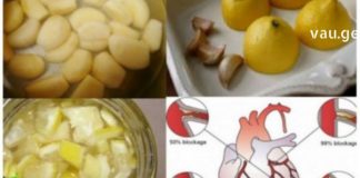 ამ სტატიაში მოცემული რეცეპტი ხელს შეუწყობს გულის შეტევისა და ინსულტის თავიდან აცილებას.