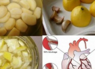 ამ სტატიაში მოცემული რეცეპტი ხელს შეუწყობს გულის შეტევისა და ინსულტის თავიდან აცილებას.