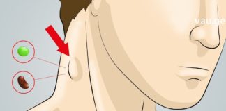 10 ყველაზე ეფექტური და სწრაფი მეთოდი ლიმფური სისტემის გასაწმენდად! – სახლის პირობებში შესალებელია მარტივად!