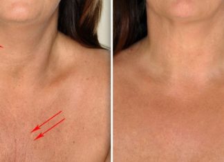 6 საუკეთესო გზა ყელისა და დეკოლტეს მიდამოში ნაოჭების მოსაშორებლად!