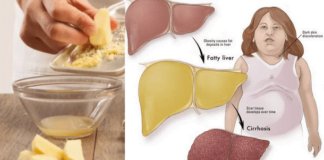 მეცნიერების აღმოჩენა: ღვიძლისა და ნაღვლის გაწმენდის 3 საუკეთესო გზა!