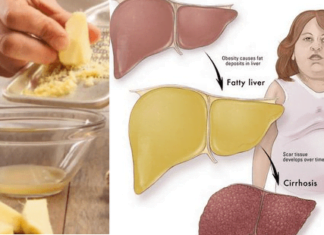 მეცნიერების აღმოჩენა: ღვიძლისა და ნაღვლის გაწმენდის 3 საუკეთესო გზა!