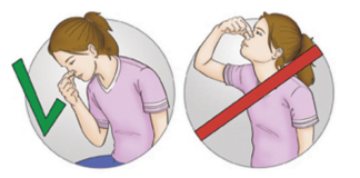 ეს ყველამ უნდა იცოდეს: როგორ შევაჩეროთ ცხვირიდან სისხლდენა…