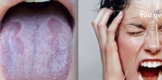 გარკვეული ვიტამინების ნაკლებობამ შეიძლება გამოიწვიოს სერიოზული შედეგები. გაგაცნობთ ვიტამინების დეფიციტის რამდენიმე სიმპტომს: