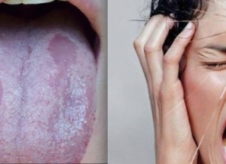 გარკვეული ვიტამინების ნაკლებობამ შეიძლება გამოიწვიოს სერიოზული შედეგები. გაგაცნობთ ვიტამინების დეფიციტის რამდენიმე სიმპტომს: