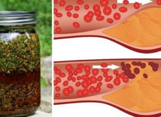 გთავაზობთ ხალხურ წამალს, რომელიც საშუალებას მოგცემთ, გაისუფთაოთ სისხლძარღვები, რათა ათეროსკლეროზმა ვერაფერი დაგაკლოთ.
