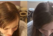 ცხიმიანმა თმამ მთელი ახალგაზრდობა გამიმწარა – ბევრი წვალების შემდეგ მივაგენი კიდეც რამდენიმე მართლაც ეფექტურ საშუალებას.