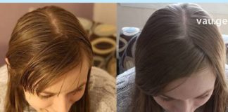 ცხიმიანმა თმამ მთელი ახალგაზრდობა გამიმწარა – ბევრი წვალების შემდეგ მივაგენი კიდეც რამდენიმე მართლაც ეფექტურ საშუალებას.