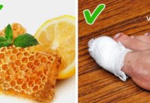 საბედნიეროდ არსებობს საშუალებები, რომელთა სახლის პირობებში გამოყენება დაგეხმარებათ ჩაზრდილი ფრჩხილის მკურნალობაში და აგაცილებთ თავიდან ამ უსიამოვნო შეგრძნებას.