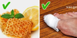 საბედნიეროდ არსებობს საშუალებები, რომელთა სახლის პირობებში გამოყენება დაგეხმარებათ ჩაზრდილი ფრჩხილის მკურნალობაში და აგაცილებთ თავიდან ამ უსიამოვნო შეგრძნებას.