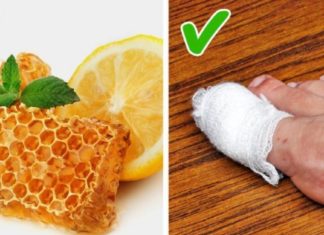 საბედნიეროდ არსებობს საშუალებები, რომელთა სახლის პირობებში გამოყენება დაგეხმარებათ ჩაზრდილი ფრჩხილის მკურნალობაში და აგაცილებთ თავიდან ამ უსიამოვნო შეგრძნებას.