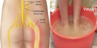 რეცეფტი, რომელიც უებარი აღმოჩნდა საჯდომის ნერვის ანთების სამკურნალოდ! მერწმუნეთ, შედეგებით გაოცდებით!