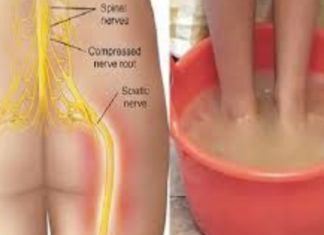 რეცეფტი, რომელიც უებარი აღმოჩნდა საჯდომის ნერვის ანთების სამკურნალოდ! მერწმუნეთ, შედეგებით გაოცდებით!