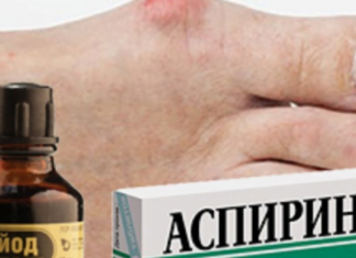 იოდი საუკეთესო დამხმარე აღმოჩნდა პოდაგრას სამკურნალოდ – საკუთარ თავზე გამოვცადე და კმაყოფილი ვარ..