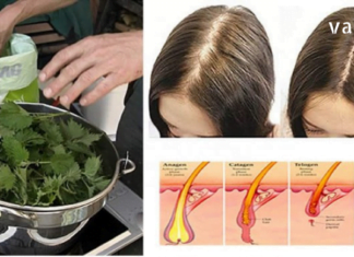 თმის ცვენის დროს მოამზადეთ ეს საშუალებები: ჭინჭრის და ძმრის ნაყენი მართლაც საუკეთესო დამხმარეა!