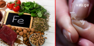 როგორ ამოვიცნოთ ჩვენს ორგანიზმში რკინის დეფიციტი? : სიმპტომები, რომლებიც ამ დროს ვლინდება!