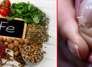 როგორ ამოვიცნოთ ჩვენს ორგანიზმში რკინის დეფიციტი? : სიმპტომები, რომლებიც ამ დროს ვლინდება!