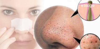 შავი წერტილები კანზე ალბათ ყველაზე გავრცელებული პრობლემაა დღევანდელ დროში, განსაკუთრებით, ცხვირის, ნიკაპის და შუბლის მიდამოში. გაგიზიარებთ ჩემს მეთოდს, თუ როგორ ვიყენებ ჩაის ხის ზეთს!