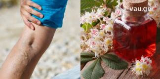 საკმარისია მოამზადოთ ეს საშუალება და თქვენ გექნებათ ჯანსაღი ფეხები ვარიკოზის გარეშე!