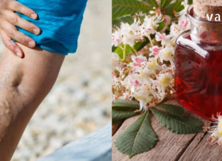 საკმარისია მოამზადოთ ეს საშუალება და თქვენ გექნებათ ჯანსაღი ფეხები ვარიკოზის გარეშე!