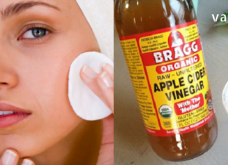 ვაშლის ძმარში ნაპოვნი ვაშლის მჟავა წმენდს კანს. ის არა მხოლოდ ბუნებრივად ამშვიდებს კანს, არამედ მოქმედებს როგორც სოკოს საწინააღმდეგო და ანტიბაქტერიული გამწმენდი.