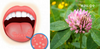 სამყურას ნაყენსა და ნახარშს უხსოვარი დროიდან იყენებენ უამრავი დაავადების სამკურნალოდ – მათშორის საუკეთესოა სტომატიტის დროს!