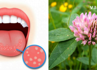 სამყურას ნაყენსა და ნახარშს უხსოვარი დროიდან იყენებენ უამრავი დაავადების სამკურნალოდ – მათშორის საუკეთესოა სტომატიტის დროს!