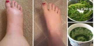 თუ თქვენ ფეხები გიშუპდებათ, პრობლემის მოგვარებას სახლში ნატურალური რეცეპტების დახმარებით შეძლებთ.