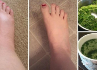 თუ თქვენ ფეხები გიშუპდებათ, პრობლემის მოგვარებას სახლში ნატურალური რეცეპტების დახმარებით შეძლებთ.