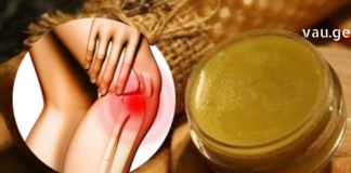 სამკურნალო კრემი სახსრების ტკივილისთვის – გამოიყენება პრობლემურ ადგილებში წასასმელად. მის შემადგენლობაში შედის ისეთი ნივთიერებები როგორიც არის: მდოგვი და თაფლი.