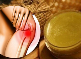 სამკურნალო კრემი სახსრების ტკივილისთვის – გამოიყენება პრობლემურ ადგილებში წასასმელად. მის შემადგენლობაში შედის ისეთი ნივთიერებები როგორიც არის: მდოგვი და თაფლი.