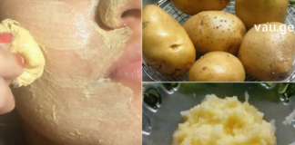 კარტოფილი მართლაც სასწაულმოქმედია, როდესაც საქმე ეხება კანის გარკვეულ პრობლემებს.