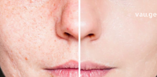 არ გაქვთ საკმარისი დრო კანის ინტენსიური მოვლისთვის? გაგიზიარებთ რამდენიმე რჩევას კანის სწრაფი გაჯანსაღებისთვის..