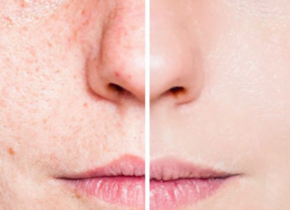 არ გაქვთ საკმარისი დრო კანის ინტენსიური მოვლისთვის?  გაგიზიარებთ რამდენიმე რჩევას კანის სწრაფი გაჯანსაღებისთვის..