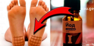 რატომ არის აუცილებელი ხშირად იოდის წასმა ? პასუხს ამ სტატიაში იპოვით!