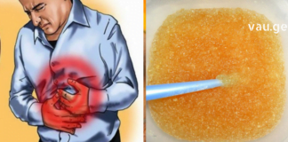 გასტრიტის მკურნალობა სახლის პირობებში უკვე შესაძლებელია იაფი ინგრედიენტებით…