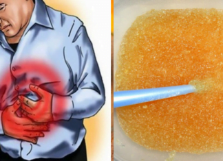 გასტრიტის მკურნალობა სახლის პირობებში უკვე შესაძლებელია იაფი ინგრედიენტებით…