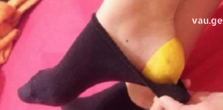 ნახეთ, როგორ უნდა დაარბილოთ დამსკდარი ქუსლები ბუნებრივად ამ საშუალებებით.. შეხვდით ზაფხულს მომზადებული.