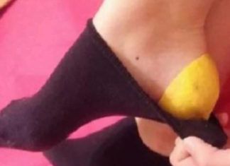 ნახეთ, როგორ უნდა დაარბილოთ დამსკდარი ქუსლები ბუნებრივად ამ საშუალებებით.. შეხვდით ზაფხულს მომზადებული.