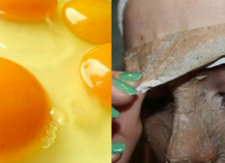 ნაოჭები გაქვთ და არ იცით რა მოუხერხოთ ? ამ ნიღბის მეშვეობით დაიბრუნებთ ახალგაზრდულ კანს. გამამკვრივებელი ნიღაბი აღიავებს და კვებავს კანს.