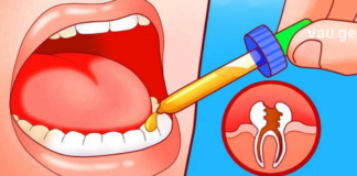 ჭაობის კოთხუჯის ფესურების ნაყენი (როგორც წყალზე, ასევე სპირტზე) კარგია პირის ღრუში გამოსავლებად კბილის ტკივილის, ღრძილების დაავადებების, პირის ღრუში უსიამოვნო სუნის დროს…