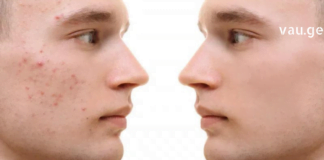 Მე, ისევე როგორც ბევრს, მუწუკების პრობლემა მაქვს. ცოტა ხნის წინ ძალიან მარტივი, მაგრამ ეფექტური რეცეპტი აღმოვაჩინე, რაც ძალიან დამეხმარა.