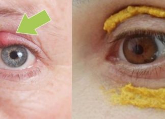 თუ თვალის ანთება გაქვთ, ან უბრალოდ დისკომფორტი გაქვთ თვალებში გახელისას და გიწითლდებათ, გასწავლით საოცრად ეფექტურ რეცეფტებს