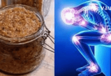 ძლიერი ვიტამინის კომპლექსი ძვლებისა და სახსრების სამკურნალოდ! ეს წამალი დაგეხმარებათ სამუდამოდ მოიცილოთ გაუსაძლისი ტკივილი!