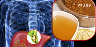 ორგანიზმის გაწმენდა ამ საშუალებებით ყველაზე კარგად მოვახერხე სახლის პირობებში!