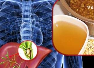 ორგანიზმის გაწმენდა ამ საშუალებებით ყველაზე კარგად მოვახერხე სახლის პირობებში!