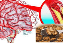 თავის ტვინის სისხლძარღვების გასაწმენდად ბევრი ხალხური საშუალება არსებობს. მაგალითად, ამ პროდუქტების დახმარებით შეგიძლიათ ეფექტურად სისხლძარღვების გაწმენდა და გაძლიერება: