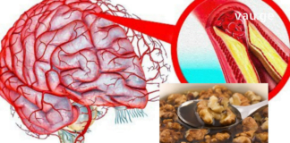 თავის ტვინის სისხლძარღვების გასაწმენდად ბევრი ხალხური საშუალება არსებობს. მაგალითად, ამ პროდუქტების დახმარებით შეგიძლიათ ეფექტურად სისხლძარღვების გაწმენდა და გაძლიერება: