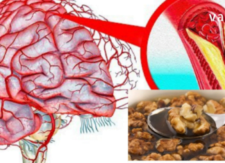 თავის ტვინის სისხლძარღვების გასაწმენდად ბევრი ხალხური საშუალება არსებობს. მაგალითად, ამ პროდუქტების დახმარებით შეგიძლიათ ეფექტურად სისხლძარღვების გაწმენდა და გაძლიერება: